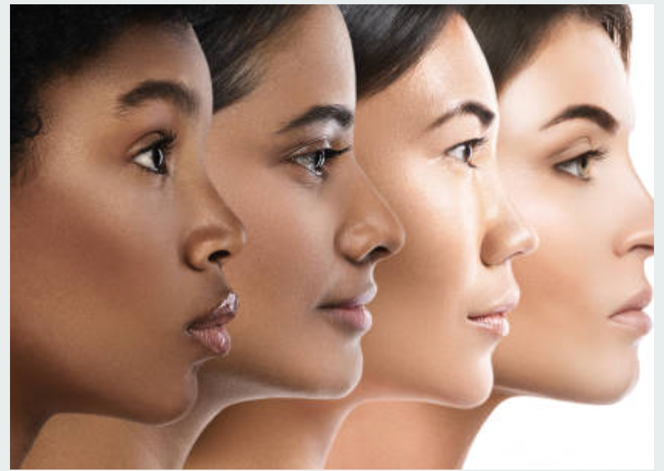 Hyperpigmentation And How to Treat It